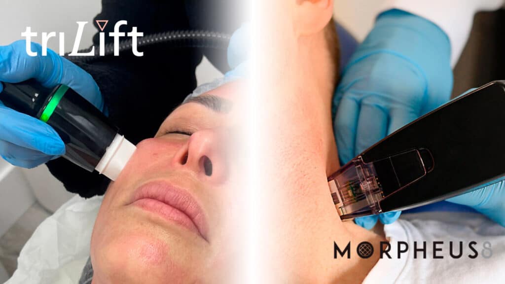 Trilift-vs-Morpheus