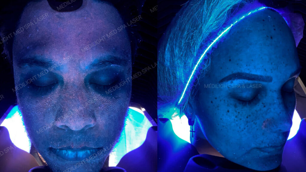 evaluación-facial