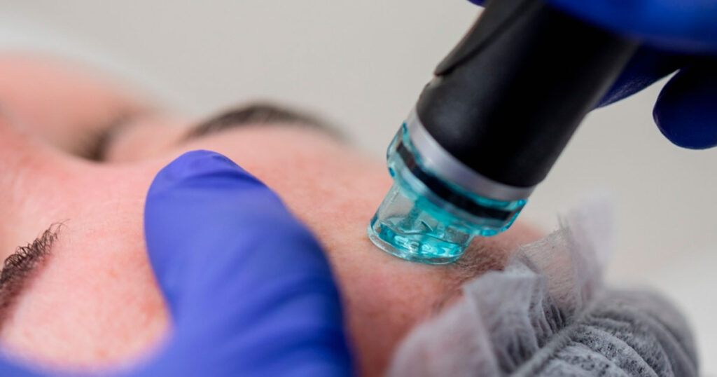 hydrafacial