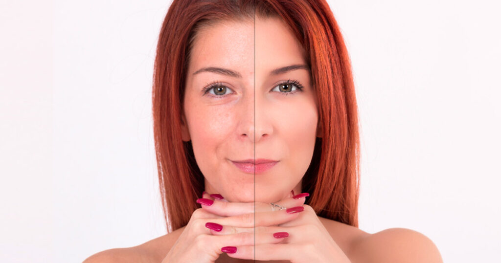 Anti-Aging-portada