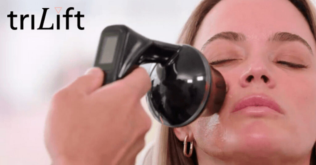 radiofrecuencia