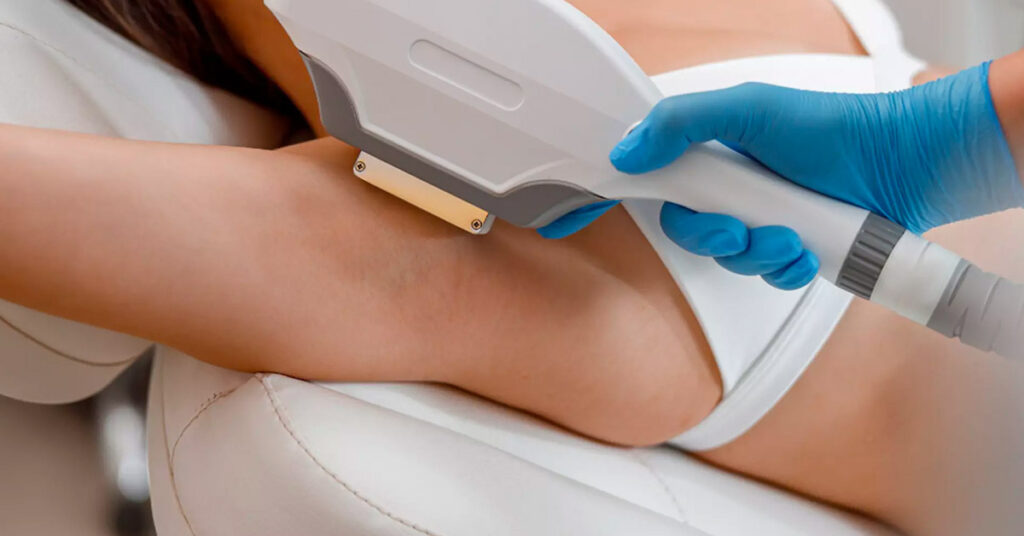 Rejuvenecimiento cutáneo con láser y reducción de poros Medilight Coral Gables Miami