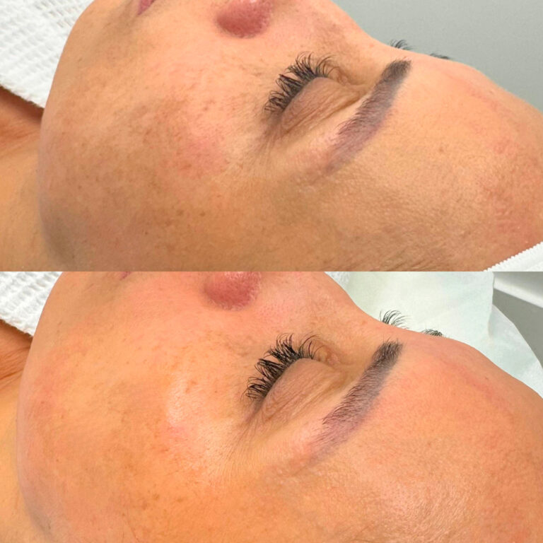 antes-y-despues